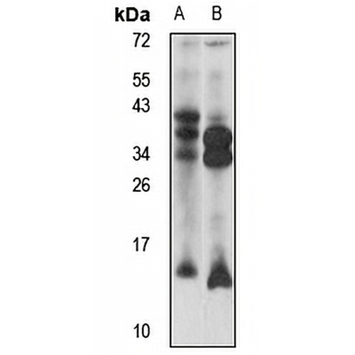 DYNLT3 Rabbit Polyclonal Antibody