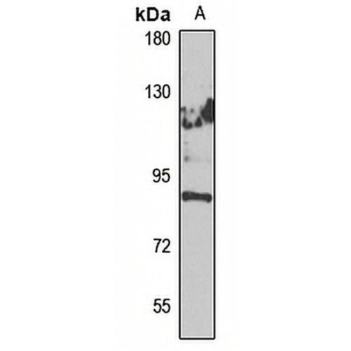 ECE2 Rabbit Polyclonal Antibody