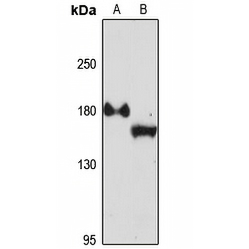 EDC4 Rabbit Polyclonal Antibody