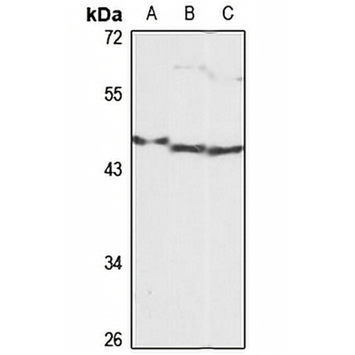 EF-CAB4B Rabbit Polyclonal Antibody