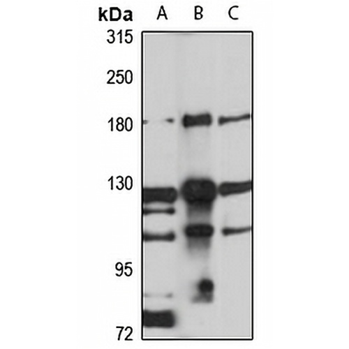 EHBP1 Rabbit Polyclonal Antibody