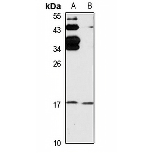 4E-BP2 Rabbit Polyclonal Antibody