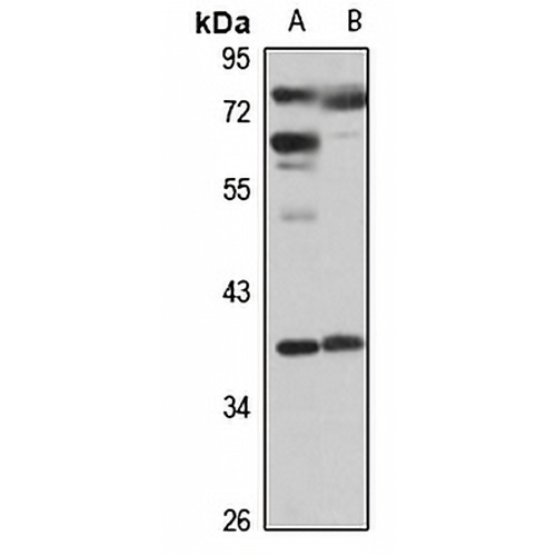 ELOVL2 Rabbit Polyclonal Antibody