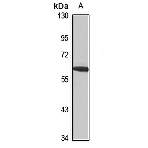 ELP3 Rabbit Polyclonal Antibody