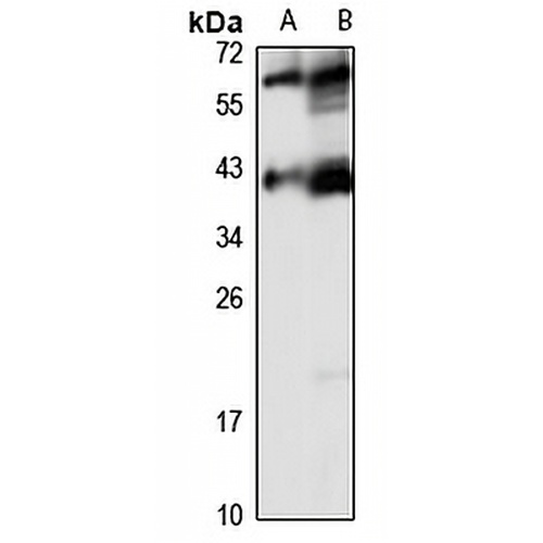ELP5 Rabbit Polyclonal Antibody