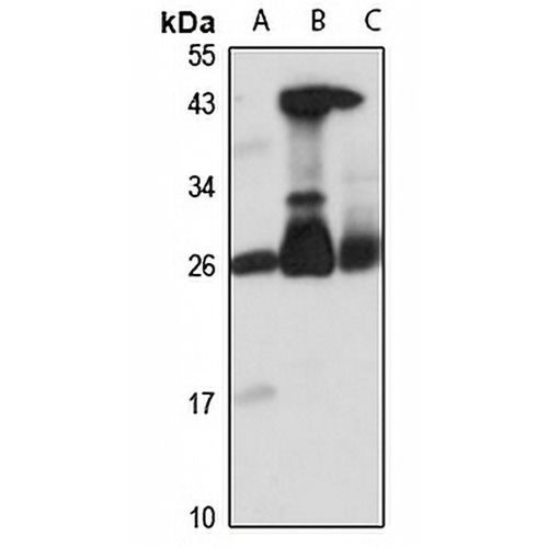 EMC8 Rabbit Polyclonal Antibody