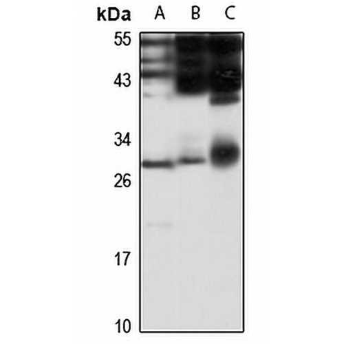 EMG1 Rabbit Polyclonal Antibody