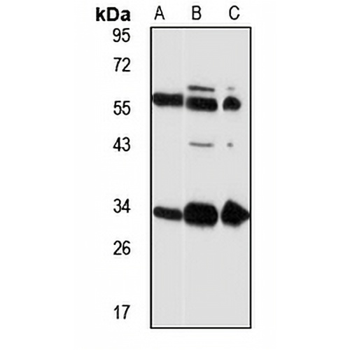 EML1 Rabbit Polyclonal Antibody