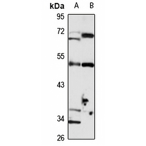ENPP4 Rabbit Polyclonal Antibody