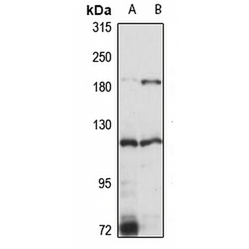 EPAS1 Rabbit Polyclonal Antibody