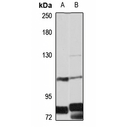 EPB41L3 Rabbit Polyclonal Antibody