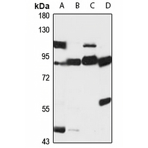 EPN1 Rabbit Polyclonal Antibody