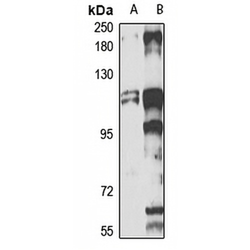 PICH Rabbit Polyclonal Antibody