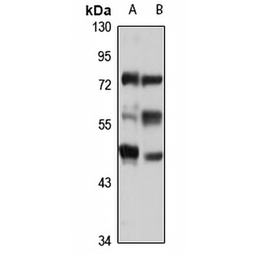 ERO1-L-beta Rabbit Polyclonal Antibody