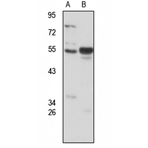 ERVW-1 Rabbit Polyclonal Antibody