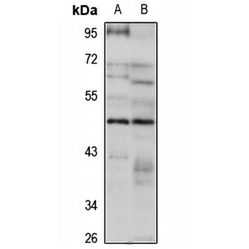 ERR beta Rabbit Polyclonal Antibody