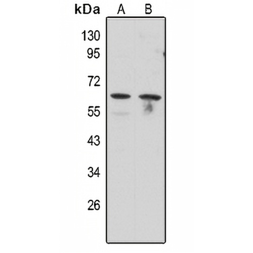 ERR gamma Rabbit Polyclonal Antibody