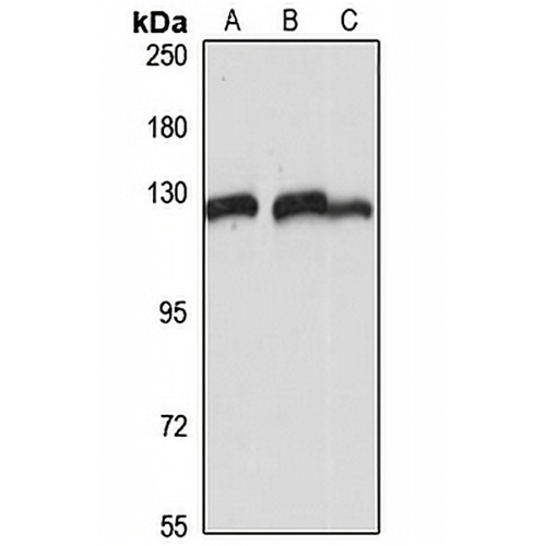 ESYT1 Rabbit Polyclonal Antibody