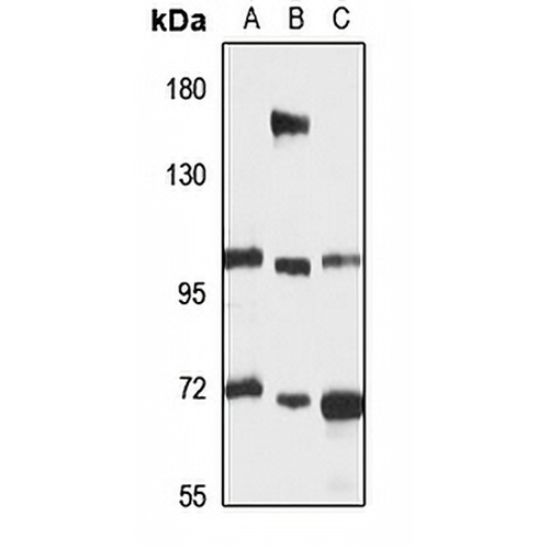 E-Syt2 Rabbit Polyclonal Antibody