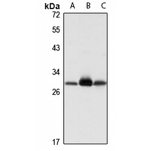 ETFB Rabbit Polyclonal Antibody
