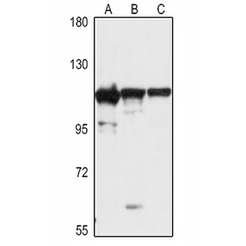 EXOSC10 Rabbit Polyclonal Antibody