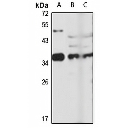 EXOSC7 Rabbit Polyclonal Antibody