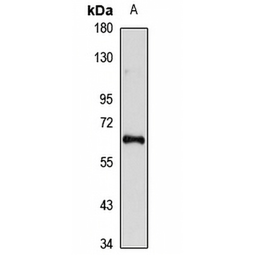 EYA2 Rabbit Polyclonal Antibody