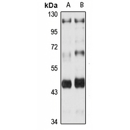 PAR2 Rabbit Polyclonal Antibody
