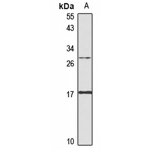 FAAP24 Rabbit Polyclonal Antibody