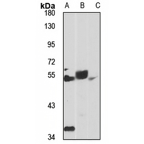 FADS1 Rabbit Polyclonal Antibody