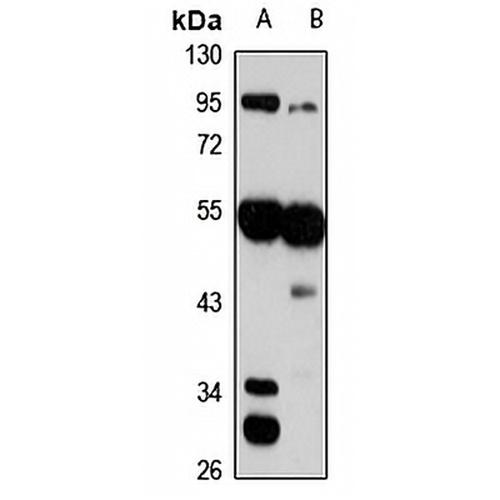 FADS3 Rabbit Polyclonal Antibody