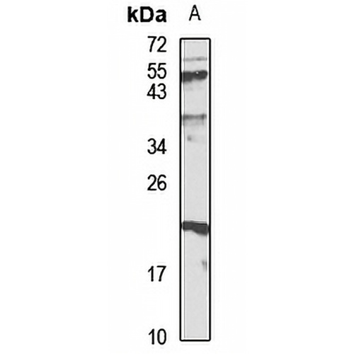 FAIM1 Rabbit Polyclonal Antibody