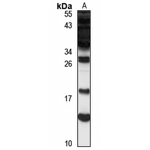 DRR1 Rabbit Polyclonal Antibody