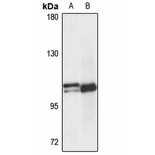 FAM13A Rabbit Polyclonal Antibody