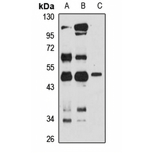 FAM46A Rabbit Polyclonal Antibody