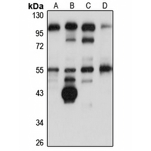 FAM46C Rabbit Polyclonal Antibody