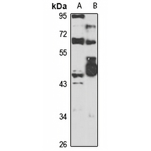 FANCG Rabbit Polyclonal Antibody