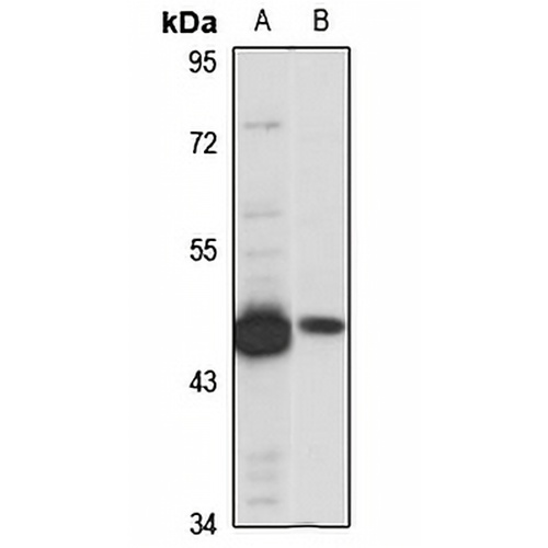 PheRS Rabbit Polyclonal Antibody