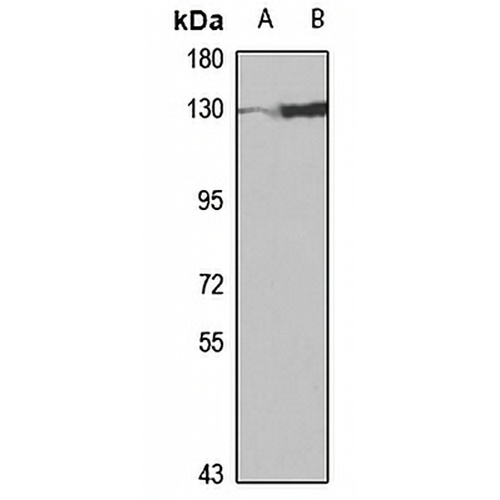 FBXO11 Rabbit Polyclonal Antibody
