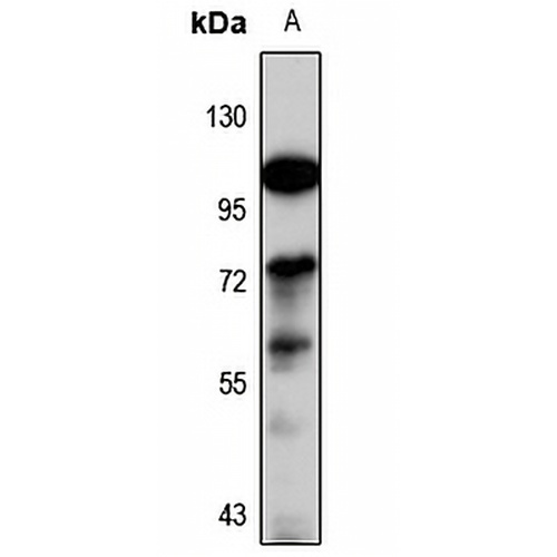 FBXO24 Rabbit Polyclonal Antibody