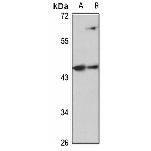 FBXO28 Rabbit Polyclonal Antibody