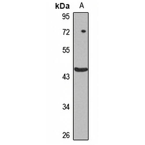 FBXW4 Rabbit Polyclonal Antibody