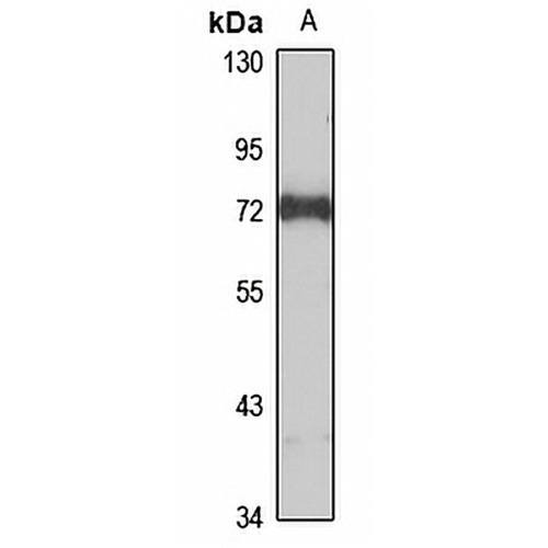 FBXW5 Rabbit Polyclonal Antibody
