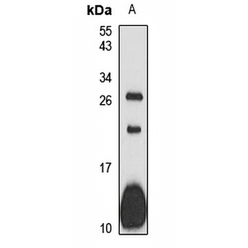 Fc epsilon RI gamma Rabbit Polyclonal Antibody
