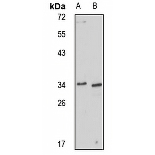 Ficolin 2 Rabbit Polyclonal Antibody