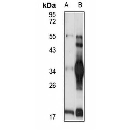 Ficolin 3 Rabbit Polyclonal Antibody