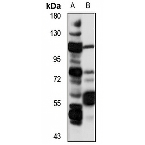 FEM1A Rabbit Polyclonal Antibody