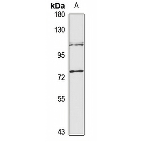 FEM1B Rabbit Polyclonal Antibody