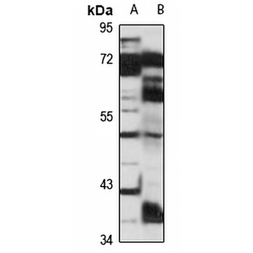 FEZF2 Rabbit Polyclonal Antibody
