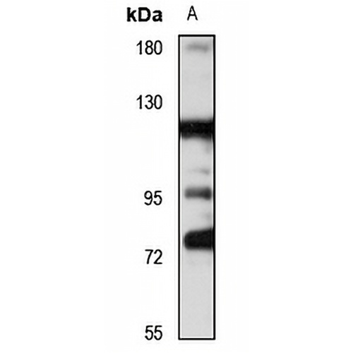 FGD1 Rabbit Polyclonal Antibody